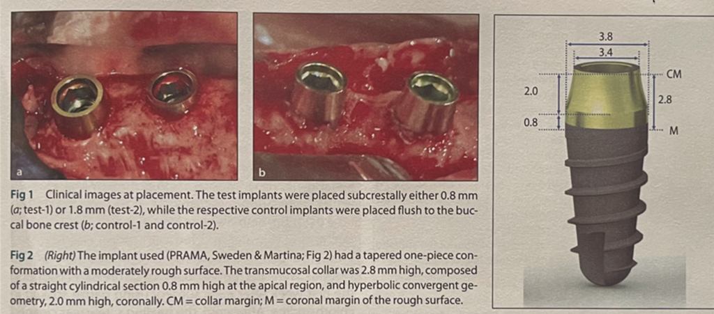 Shortcomings of the Ditron Ultimate Implant