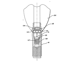 patent for paragon 1997 1999 multi part multi positionable abutment for use with dental implant
