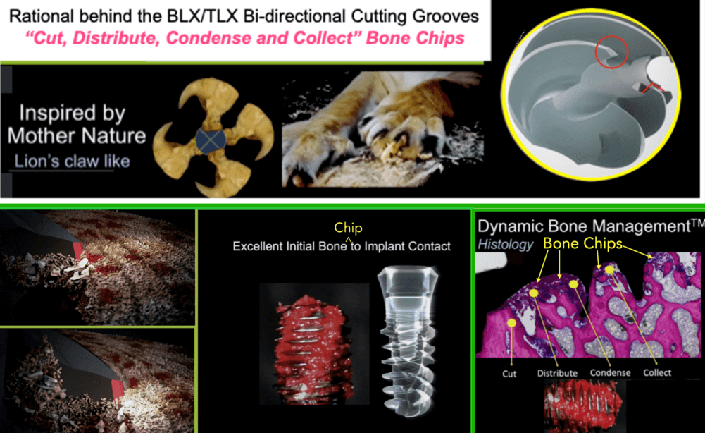 straumann controversies rational behind the blx/tlx bi-directional cutting grooves