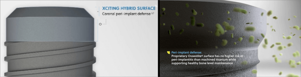 surface of zimvies osseotite