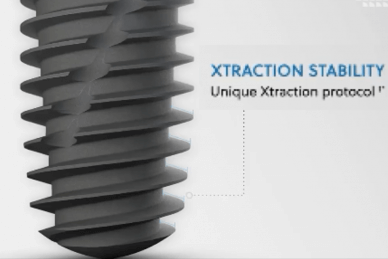 threads of zimvies implant