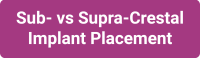 link to the sub vs supra crestal implant placement section of the paragon newsletter vol 1