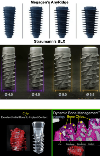 comparing megagens anyridge implant with straumanns blx implant
