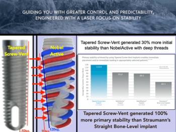 comparing the threads of the tapered screw vent implant with nobelactive implant