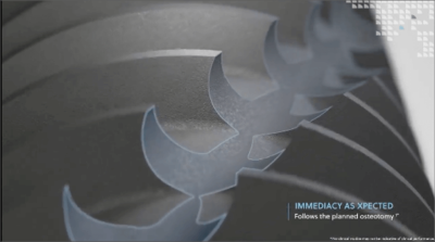 bi-directional cutting grooves on the tsx and t3 pro implants