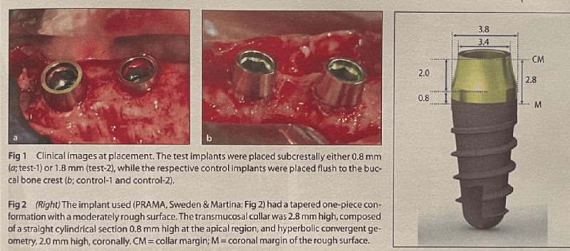 on the left clinical images of test implants placed subcrestally while the respective control implants were placed flush to the buccal bone crest and on the right implant with a tapered one-piece conformation