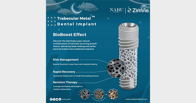 Shortcomings of ZimVie's Tapered Screw-Vent with Trabecular Metal