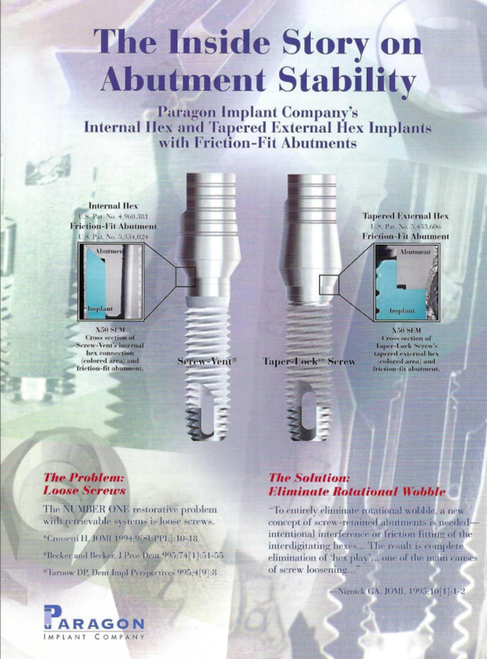 cover of the inside story on abutment stability article