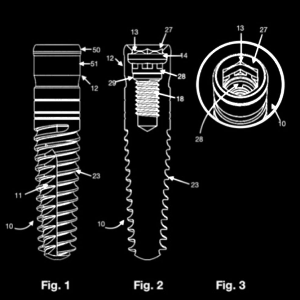 Dual Function Dental Implants