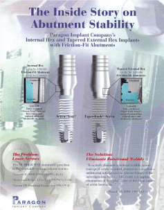 the inside story of abutment stability brochure cover