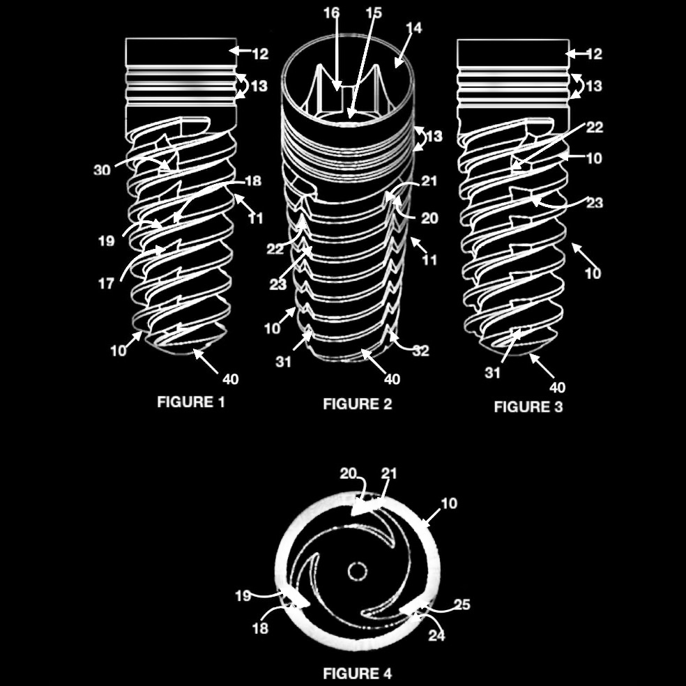 Self-Tapping Externally Threaded Dental Implants Including Bi-Directional External Cutting Grooves